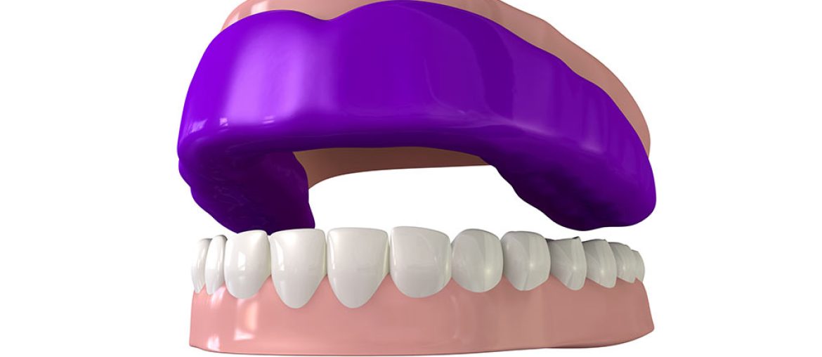 Mouthguard on Dental model